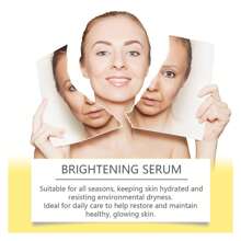 Brightening Serum, A Facial Blemish Calming, Hydrating, Firming And Brightening Serum - Multicolor - View 3