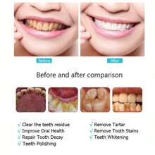 Electric Toothbrush Rotary Rechargeable Electric Toothbrush For Adults Rotating - White - View 7