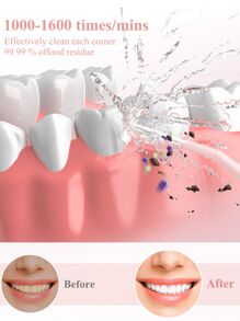 sejoy Fashion Portable Rechargeable USB Charging Electric Water Flosser Oral Irrigator Oral Irrigator Cordless Teeth Cleaner, 5 Pressure Levels&Low Noise&360° Rotation , IPX7 Waterproof, Smart Memory,270ml Removable Water Tank, For Home And Travel - 粉色 - 查看 5