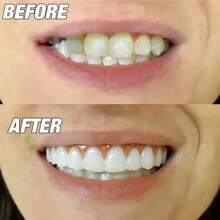 Set da 4 pezzi di nuovi apparecchi dentali superiori e inferiori impermeabili, protesi dentali simulate, decorazione per un sorriso perfetto