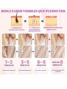 Permanent Pulsed Light Laser Hair Removal Device LPL, Hair Removal Machine, - 白色 - 查看 2