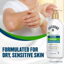 Gold Bond Healing Sensitive Body And Face Lotion - 13oz - 1 - View 3