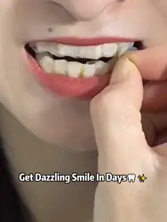 SlowSunday Deluxe 牙齿美白贴 - 無色 - 查看 2