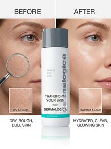 Dermalogica 祛痘控油洁面乳 8.4盎司/250毫升 - 彩色 - 查看 4