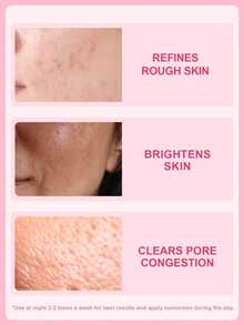 SlowSunday AHA + BHA Peeling Serum, With Lactobionic Acid & Salicylic Acid, Precisely Targeting Dullness, Roughness, Blemishes, Exfoliating, Suitable For Oily Skin, Suitable For Fall & Winter, Autumn Essential, Y2K, Halloween & Christmas - Clear - View 2