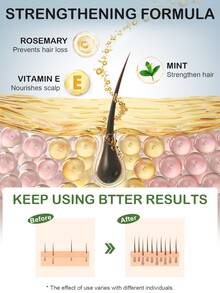 Slow Sunday Rosemary Hair & Scalp Essential Oil, Rosemary, Strengthen Hair, Intensive Scalp Care, Suitable For All Hair Types, Good Choice For Vacation, Travel Essentials, Halloween & Christmas, Suitable For Fall & Winter Hair Care, Autumn Essential - Clear - View 4