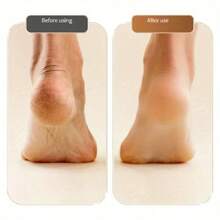 SHEIN Electric Foot Scrub, Rechargeable Portable Electric Foot Callus Removal, 2 Grinding Heads Of Different Thicknesses, Professional Foot Care Tools, Foot Care To Remove Dead Skin, Ideal Gift - Multicolor - View 6