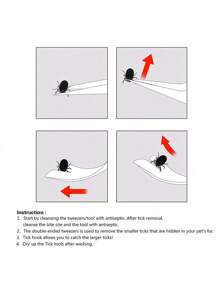 Lice Removal Kit, Stainless Steel Lice Removal Tweezers Lice Removal Tool Set, Suitable For Pet Dogs, Cats, And Humans, With A Storage Box - Multicolor - View 8