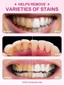 Slow Sunday PAP+牙齿美白粉，去除烟渍、咖啡渍、茶渍，保持口腔洁净亮白 - 粉色 - 查看 2