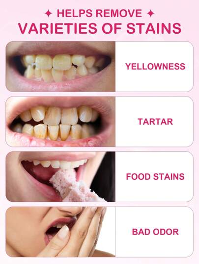 Tiras blanqueadoras de dientes Slow Sunday PAP+, elimina las manchas de humo, café y té, mantén tu boca limpia y blanca