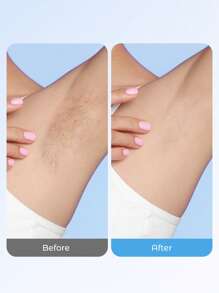 Teckwe 女士比基尼修剪器，适合丝绸肌肤的无痛电动剃须刀，带陶瓷刀头和 Type-C 充电端口的无线剃须刀，适合旅行，夏季海滩，蓝色 - 藍色 - 查看 2