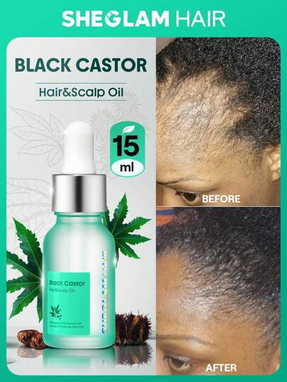 SHEGLAM HAIR Rödlök Hår- och hårbottenolja -15 ml/0,5 Fl Oz, Hårstärkande olja, Hårvård eterisk olja, Rödlök Hydrating Oil Serum, Stärker rötter, Minskar kluvna toppar, Mjuka hårstrån i överflöd, Lättviktig och snabbabsorberande, Berikad med rödlöksolja och rödlöksolja och rödlöksolja. Slutar hår Gradering Födelsedag Gåva Semester Vinter Rosa Vibe Smink Part Strand Resa Camping Skola Campus Festivaler Ros Presentera Flicka Charm Bäst Alla hjärtans dag Kvinnodagen Älska dig själv