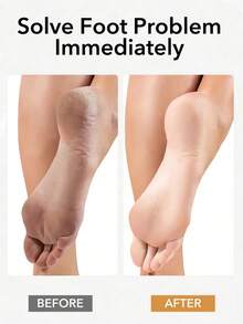 1PC Professional Pedicure Tool Beech Wood Foot File Rasp Callus Remover For Dead Skin Crack Heels Foot Care Scrubber Pumice Stone Pedicure Supplies Men Women Home Salon Use Foot Massage Tool Hard Skin Remover - Multicolor - View 6