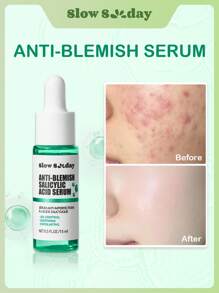 Suero de ácido salicílico antimperfecciones SlowSunday, cuidado de la piel, suero facial, suero de ácido salicílico, removedor de imperfecciones, anti-acné