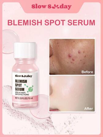 Slow Sunday Blemish Spot Serum, Salicylic Acid, Anti-Blemish, Unclog Pores & Reduce Excess Oil,  Improve Blackheads And Pimples