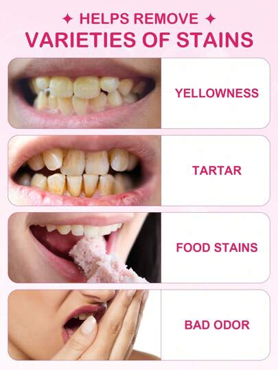 SlowSunday PAP+ Teeth Whitening Strips, Get Rid Of Smoke Stains, Coffee Stains, Tea Stains, Keep Your Mouth Clean And White