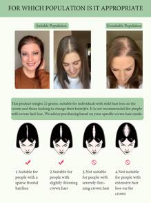 Hair Toppers For Women Real Human Hair, 10 Inch 360° 3D Upgrade Middle Part Toppers For Women With Thinning Hair - SNatural - View 7