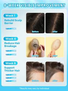 SHEGLAM HAIR Ice Revive Scalp Serum,Cooling Alpine Water Roll,Hair Massage Serum Roll,Soothe Hydrate Scalp,Strenghten Hair Roots,Enhance Scalp Skin Barrier,Reduces Hair,No-Rinse,Fast-Absorbing Daily Nourishing,Gentle Care For Women & Men Graduation Birthday Holiday Summer Fall Autumn Y2K Fancy Fashion Women Makeup Cosmetic Party Beach Travel Camping Outdoors School Campus Festivals Decor Gift Present Rose Girl Best Color Charm Vibe Pink Christmas New Year Thanksgiving Day Valentine's Day