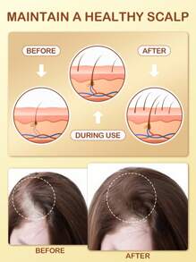 Slow Sunday Biotin Hair & Scalp Essential Oil, Biotin, Rosemary Oil, Get Weightless Hair Care, Maintain A Healthy Scalp, Suitable For All Hair Types, Ideal For Holiday, Party, Travel, Outdoor Activity, Y2k Fashion, And Cosplay, For Valentine'S Day, Valentines Gift, Suitable For Spring Personal Care - Clear - View 2