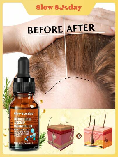 Slow Sunday Biotion Hair Oil, Botion Hair & Scalp Essential Oil, Biotin, Rosemary Oil, Get Weightless Hair Care, Maintain A Healthy Scalp, Autumn Winter Hair Scalp Care, Party And Gift