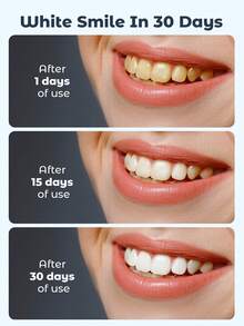 Teckwe 4-Pen Wireless Teeth Whitening Kit , Advanced LED Accelerator,Rapid Stain Removal At Home, Clinically Proven, Gentle & Effective Whitening Solution, Beauty Tools For Home