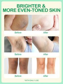 SlowSunday Retinol Brightening Cream, With Retinol, Niacinamide, And Vitamin E, Body Whitening Cream, Even Skin Tone, Skincare, Moisturizes And Brightens, Y2K, For New Year, Suitable For Winter, Cozy Winter Styles, For Valentine's Day, Valentines Gift, Valentines Day Gift, Ideal For Party - Clear - View 2