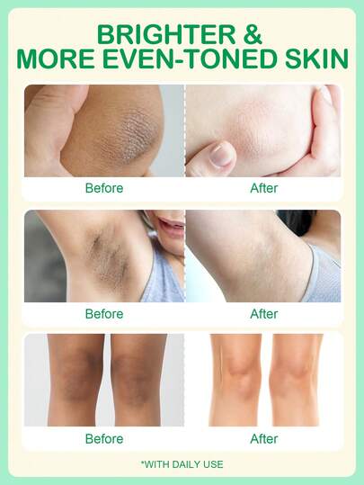 Crema iluminadora de retinol SlowSunday, con retinol, niacinamida y vitamina E, crema blanqueadora corporal, tono de piel uniforme