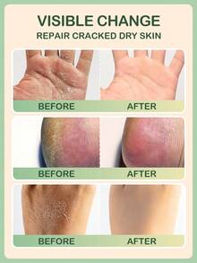 SlowSunday Tea Tree Balm, With Tea Tree Oil, Vitamin E, Aloe Vera Extract, Deeply Nourishes, Improves Old Dead Skin, Removes Dead Skin, Softens Skin, Suitable For Body & Foot & Hand, Cozy Fall & Winter Styles, Suitable For Autumn Winter, Y2K, For Halloweens, Party & Gifts, Thanksgiving & New Year, Thank You Gift, For Christmas,  Christmas Gifts