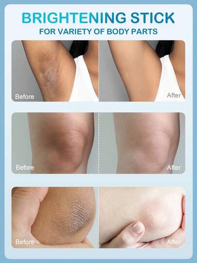 Barra iluminadora de piel con niacinamida SlowSunday, con vitamina C, vitamina E y niacinamida, mejora el aspecto apagado, ilumina, suaviza la piel, iguala el tono de la piel, para axilas, rodillas, codos y línea del bikini, estilos acogedores de otoño e invierno, adecuado para otoño e invierno, Y2K, para Halloween, fiestas y regalos, Acción de Gracias y Año Nuevo, regalo de agradecimiento, para Navidad, regalos de Navidad