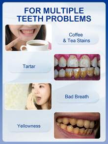 Slow Sunday Teeth Whitening Pen, Get Rid Of  Smoke Stains, Coffee Stains, Tea Stains, Keep Your Mouth Clean And White,, Good Gift For Holiday, Party, Travel, Outdoor Activity, For Valentine'S Day, Valentines Gift, Suitable For Spring Personal Care - White - View 2