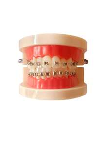 Oral Metal Bracket Model, Clinic Patient Communication Display Dental Model, Dental Teeth Bracket Model - Multicolor - View 2