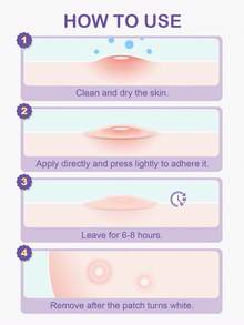 Parches para el día y la noche SlowSunday, apósito hidrocoloide con ácido salicílico, adecuado para la noche, impermeable y transpirable, refrescante y cómodo, suave y no irritante, para el cuidado diario, mejor cobertura, para la cara y el Body, para cubrir granos y manchas, parches para el acné, para el invierno, cuidado de la piel, Y2K, Año Nuevo, para el Día de San Valentín, regalo de San Valentín, regalo del Día de San Valentín, para el Ramadán, reuniones y regalos del festival del Ramadán, ideal para fiestas - Day & Night - Ver 4