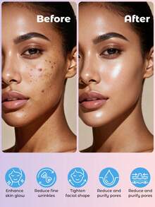 Teckwe 高频祛痘仪，个人护肤仪，含4个高频美容棒，电疗棒，电疗梳，全身电疗仪，微电流美容仪万圣节礼物-美国插头 - 美規A型插(110-127V) - 查看 3