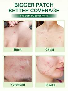 SlowSunday Pro+ 通用祛痘贴，104 片装，舒缓肌肤，水胶体材质，超薄设计，全覆盖，防水透气，清爽舒适，温和不刺激，妆前及日常护理皆可使用，遮瑕效果更佳，适用于面部及身体，有效遮盖痘痘和瑕疵，是约会、生日、周年纪念日或任何特殊场合的理想之选，派对必备，夏季适用。 - 無色 - 查看 2