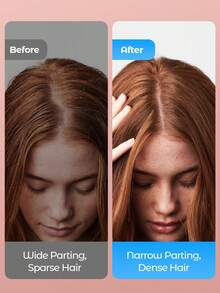 Teckwe Electric Scalp Massage Comb, Red Light Hair Care Comb, Three Modes Available, Type-C Charging Scalp Care Massage Comb Red Light Hair Loss Prevention Hair Device Head Medication Device Hair Liquid Introduction Comb 1400mAh - Multicolor - View 4