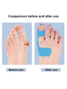 8 Elastic Toe Correction Straps Breathable Separator Self Adhesive Hallux Valgus Orthosis For Men Women Foot Care Must Have Accessory - Multicolor - View 3