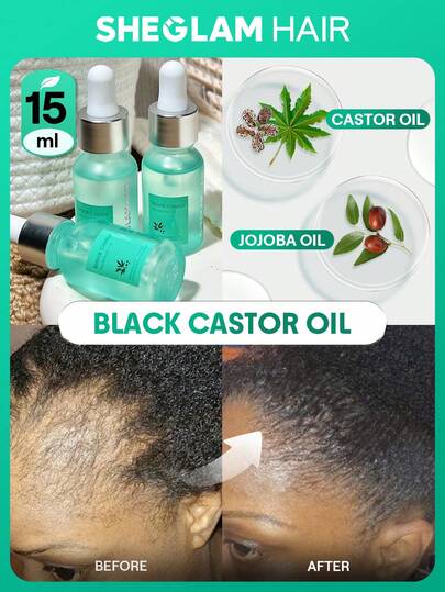 Black Castor Hair & Scalp Oil-15ml/0.5 Fl Oz,Hair Strengthening Oil,Hair Care Essential Oil,Castor Oil Hydrating Oil Serum,Moisturize Dry Scalp,Hydrate Thirsty Strands,Boost Elasticity And Shine,Enriched With Castor Oil,Jojoba Oil And Squalane Suitable For Curly Hair And Repair Permed Damaged Hair Birthday Gift Pink Vibe Makeup Party Beach Travel Camping School Campus Festivals Rose Present Girl Charm Best Women's Day Love Yourself Spring Hair Care