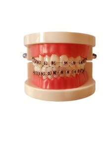 Modelo de soporte metálico oral, modelo de visualización de comunicación con pacientes de clínica, modelo de soporte dental - Multicolor - Ver 9