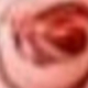 Hồng