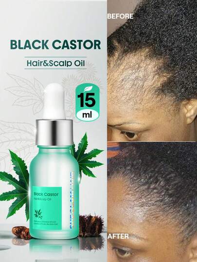 SHEGLAM HAIR Aceite para cabello y cuero cabelludo de ricino negro, 15 ml/0,5 onzas líquidas, aceite fortalecedor del cabello, aceite esencial para el cuidado del cabello, suero de aceite hidratante de aceite de ricino, humecta el cuero cabelludo seco, hidrata las hebras sedientas, aumenta la elasticidad y el brillo, enriquecido con aceite de ricino, aceite de jojoba y escualano adecuado para cabello rizado y reparación de cabello dañado con permanente Cumpleaños Regalo Día festivo Rosa Onda Constituir Playa Escuela Festivales Rosa Chica Cuidado del cabello Y2K Día de la Madre Artículos esenciales para viajar Vacaciones Verano Artículos esenciales para un crucero plancha de pelo rizador de pelo plancha para el cabello planchas para el pelo