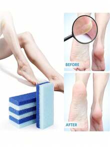 1/4Pcs Foot Pumice Stone Exfoliating File, Callus Dead Skin Remover, Heel Brush, Salon Foot Scrub Pad, Pedicure Exfoliating Tool For Men And Women, Bag, Organizer, Storage For Holiday Gift Giving-Blue, Shower Caddy - blue - View 11