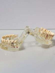 1pc Dental Implant Model, Pathological Tooth Model, Detachable Oral Model, Bridge Demonstration Model For Dental Care - 1PC - View 16