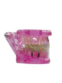 1pc Dental Implant Model, Pathological Tooth Model, Detachable Oral Model, Bridge Demonstration Model For Dental Care - 1PC - View 5