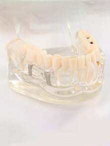 1pc Dental Implant Model, Pathological Tooth Model, Detachable Oral Model, Bridge Demonstration Model For Dental Care - 1PC - View 13