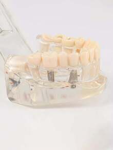1pc Dental Implant Model, Pathological Tooth Model, Detachable Oral Model, Bridge Demonstration Model For Dental Care - 1PC - View 12