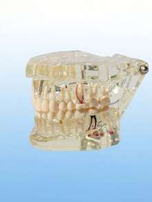 1pc Dental Implant Model, Pathological Tooth Model, Detachable Oral Model, Bridge Demonstration Model For Dental Care - 1PC - View 8