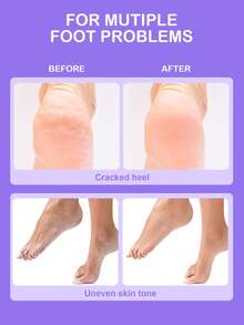 SlowSunday Lavender Foot Cream, Anti-Drying Crack Foot Cream, Hand And Foot Skin Care, Moisturizing, Soothing Skin, Deep Nourishment, With Multiple Plant Oils, Skincare, Suitable For Fall & Winter, Autumn Essential, Halloween & Christmas - White - View 3