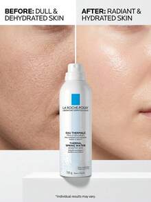 La Roche-Posay Thermal Spring Water 150 Ml – Facial Spray, Soothing, For Sensitive Skin, Fragrance-Free, Mineral-Rich Water, Suitable For After Sun Relief - Clear - View 4