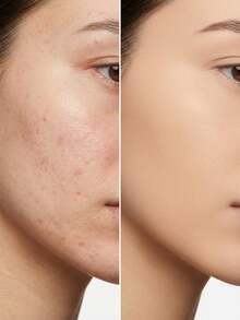 Yves Saint Laurent All Hours Foundation LN8 25 Ml – Foundation, Full Coverage, For Women, LN8, Suitable For Daily Makeup Routine - Multicolor - View 4