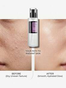 COSRX AHA 7 WHITEHEAD POWER LIQUID, Minimalist & Multi-Functional – Chemical Exfoliant, Exfoliating, For Dull Skin, 7% Glycolic Acid, Suitable For Night Skincare Routine - Clear - View 4